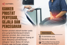 Jenis makanan yang dimaksud dimaksud mampu turunkan risiko karsinoma prostat