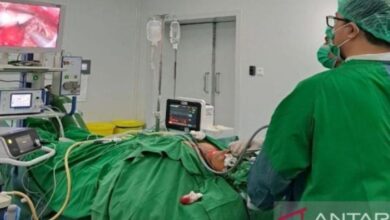Apa semata pemicu usus buntu? Hal ini ulasannya