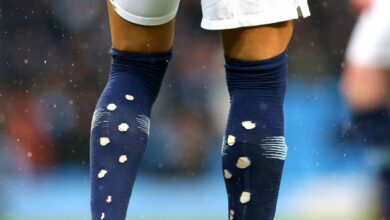 Mengapa pesepak bola pada waktu ini melubangi kaus kakinya? Hal ini alasannya