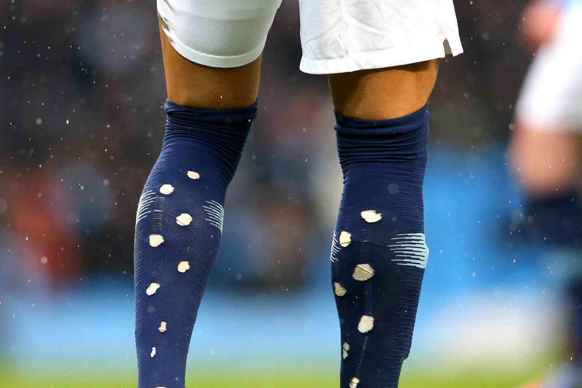 Mengapa pesepak bola pada waktu ini melubangi kaus kakinya? Hal ini alasannya